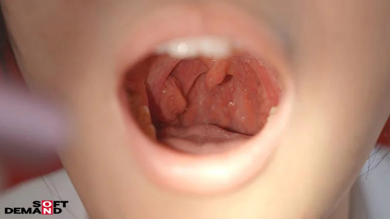 口内もよく見てみる！